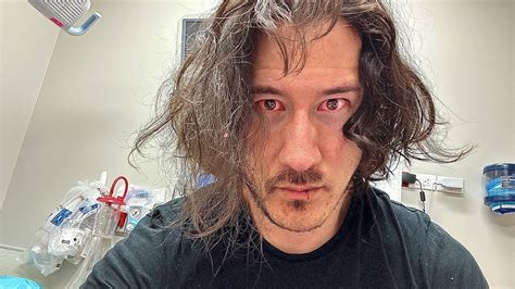 markiplier blood in eyes|Markiplier updates fans after surprising hospital selfie